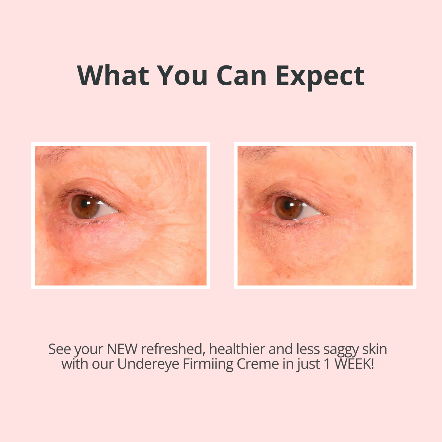VELMEIRA™ Real-EYEZ-ation Undereye Eye Gel by Dr. Terry Dubrow