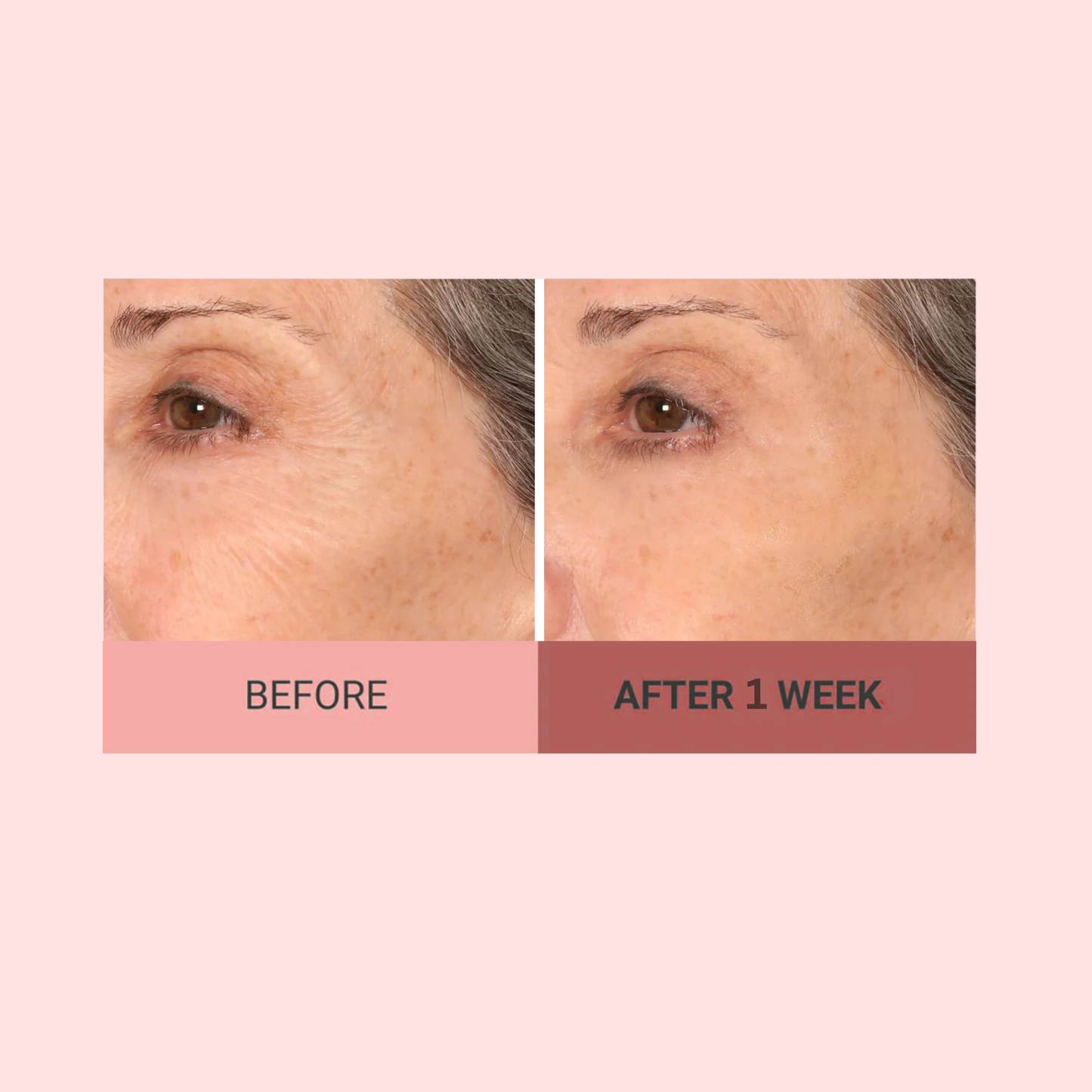 VELMEIRA™ Real-EYEZ-ation Undereye Eye Gel by Dr. Terry Dubrow
