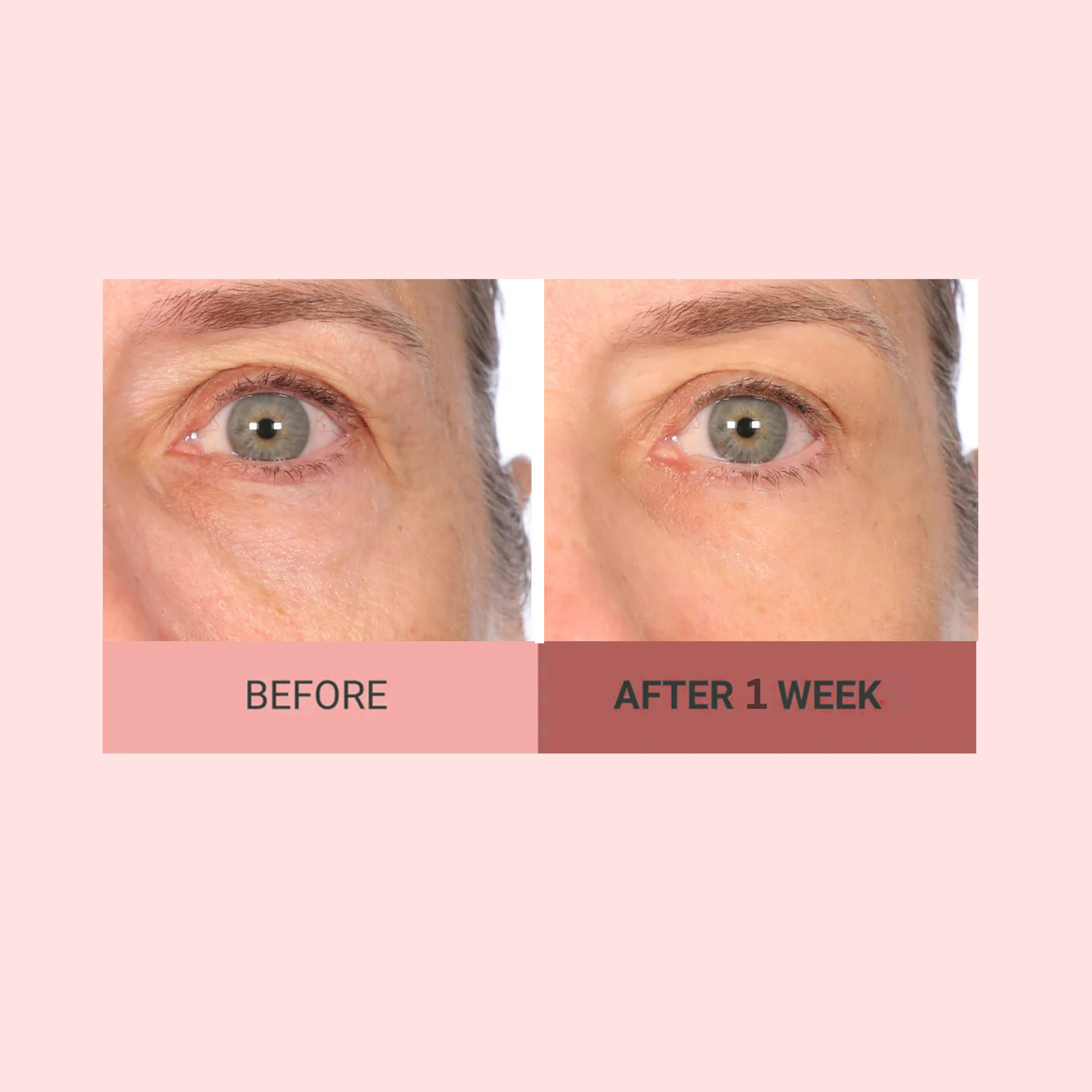 VELMEIRA™ Real-EYEZ-ation Undereye Eye Gel by Dr. Terry Dubrow