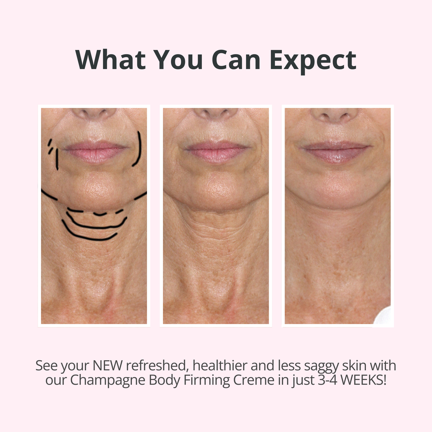 VELMEIRA™ Champagne Body Firming Creme by Dr. Terry Dubrow
