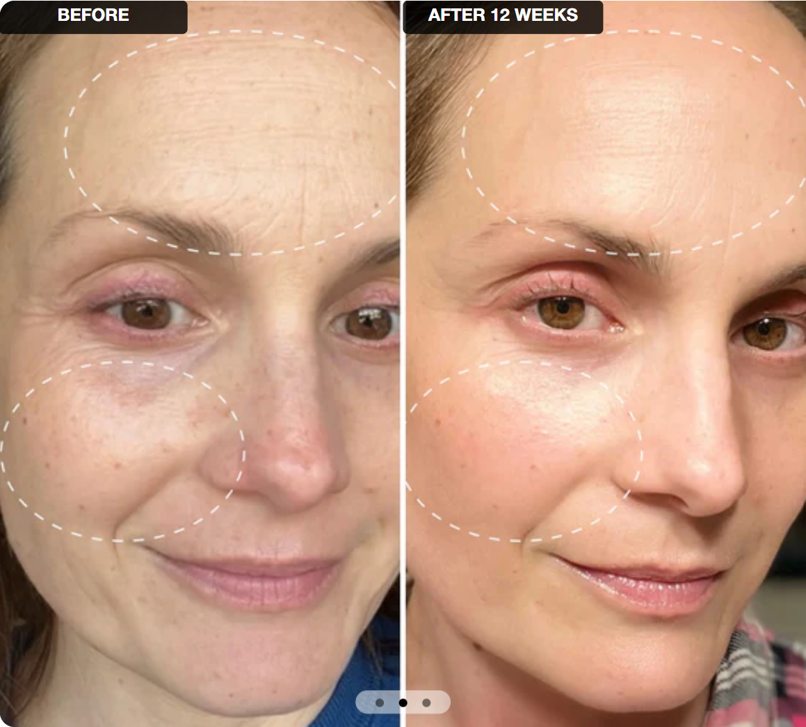 VELMEIRA™ Anti-Aging Retinal Shot