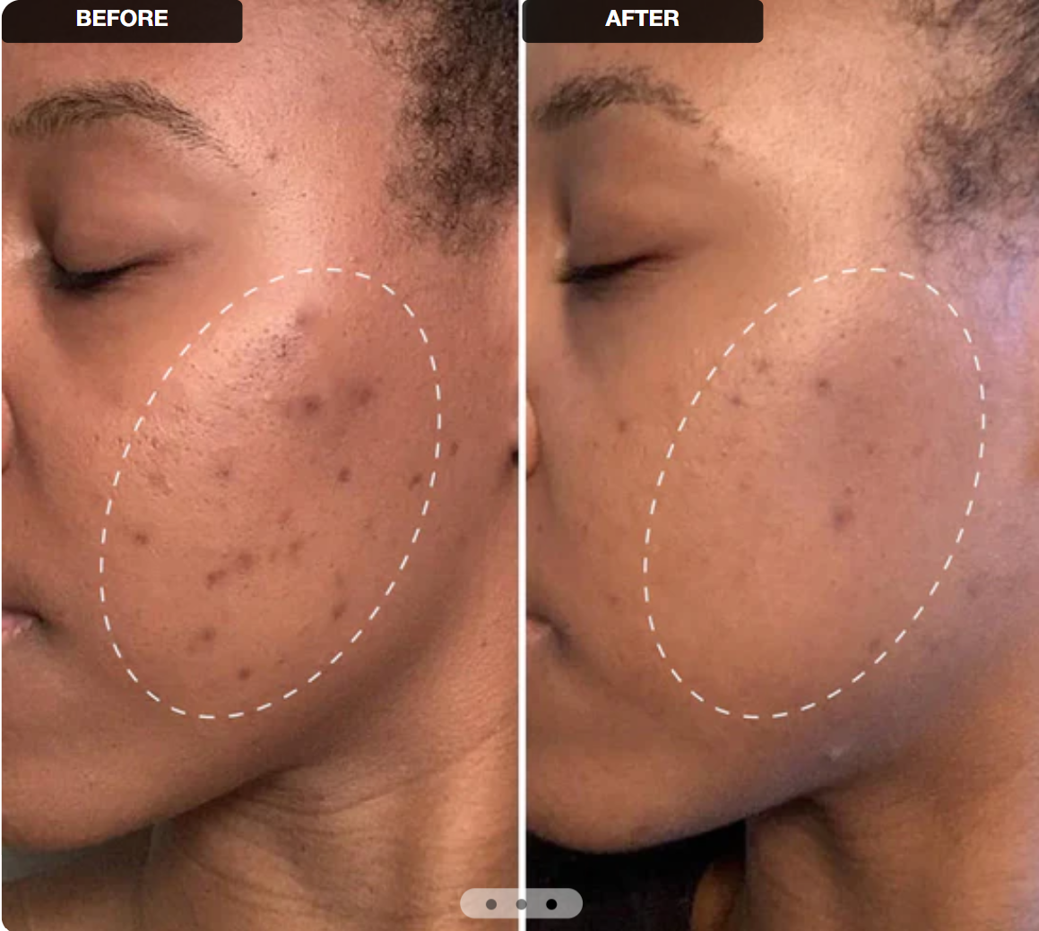 VELMEIRA™ Anti-Aging Face Retinol Cream