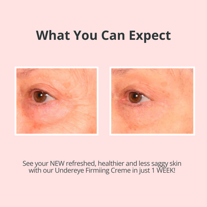 VELMEIRA™ Real-EYEZ-ation Undereye Eye Gel by Dr. Terry Dubrow