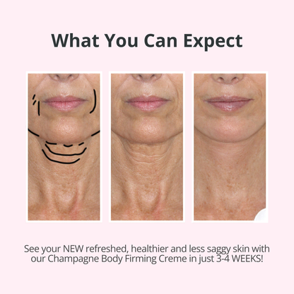 VELMEIRA™ Champagne Body Firming Creme by Dr. Terry Dubrow