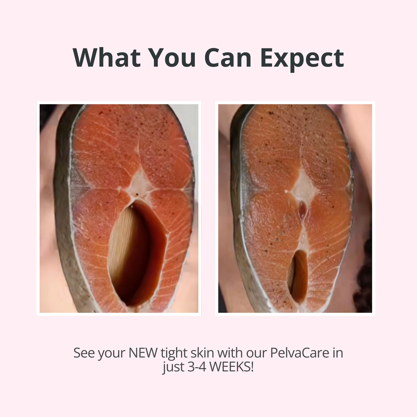 VELMEIRA PelvaCare™ Pelvic Floor Trainer