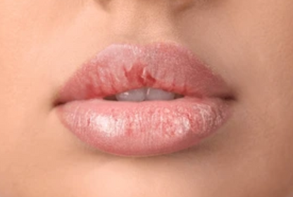VELMEIRA™ Korean Hydrating Lip Oil
