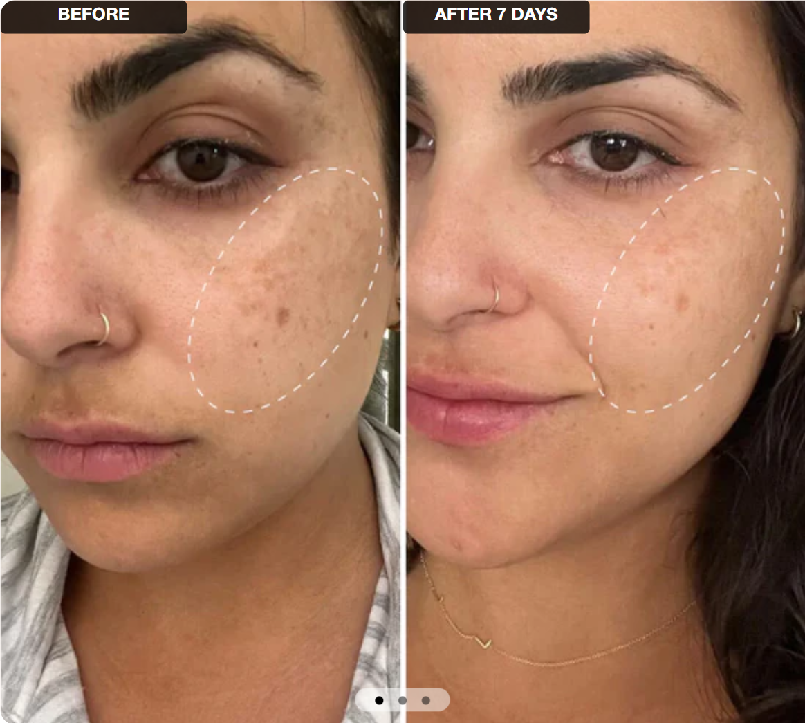 VELMEIRA™ Anti-Aging Retinal Shot