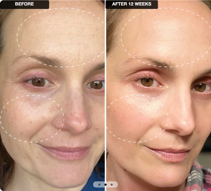 VELMEIRA™ Anti-Aging Face Retinol Cream