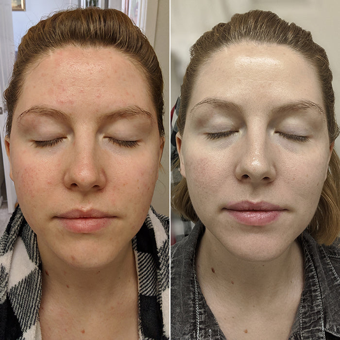 VELMEIRA™ Methylene Blue Face Serum